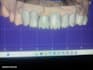design high precision 3d dental models