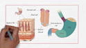 create medical whiteboard animation videos
