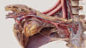 create medical illustration and diagram