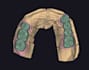 provide professional exocad dental design and 3d modeling services