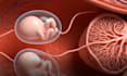 create 3d medical animation, anatomy animation, medical explainer video