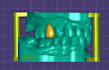 design dental crowns, bridges, veneers, and implants using exocad
