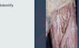 teach you anatomy spotters using real cadaveric images