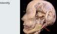 teach you anatomy spotters using real cadaveric images