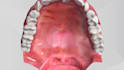 create 3d dental medical animation, 3d clear aligner simulation animation video