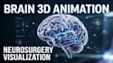 create 3d brain neurosurgery animation, medical anatomy