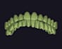 reliable dental cad cam outsourcing service