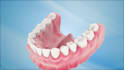 create realistic 3d dental implant and dental procedure animations