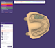 design dental crown and bridge using exocad