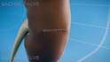 create professional 3d medical animation and visualization