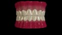 create 3d dental animation, medical animation, 3d dental explainer video