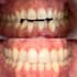 create expert clear aligner treatment plans for orthodontists