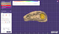 design crowns and bridges using exocad