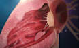 create a professional 3d medical animation video
