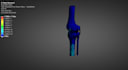 perform stress analysis and biomechanical behavior in ansys