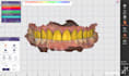 provide professional exocad dental cad design services