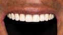do professional dental cad design using exocad