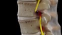 create 3d orthopedic spine and musculoskeletal animation anatomy video