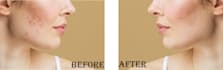 edit bulk photos retouching fast