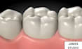 create cinematic 3d medical animation, dental explainer video
