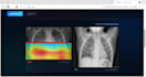build an ai powered medical image analysis web application
