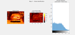 do matlab image and signal processing, simulink, pid and numerical analysis,gui