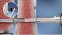 create 3d medical device animation for medtech and healthcare companies