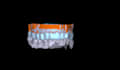 design occlusal splints, night guards and retainers
