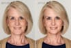 do professionally edit your photos and improve image quality