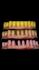 create professional exocad dental cad designs