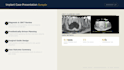 design your digital implant case presentation