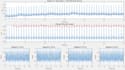 ecg signal processing, arrhythmia detection, and biomedical data analysis