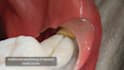 create 3d dental animation, dental procedure, dental implant and oral surgery
