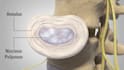 create realistic 3d spine animation and surgical visualization