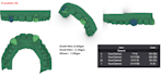 design any high end custom grillz in 3d cad