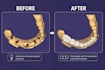 provide professional dental cad design using exocad