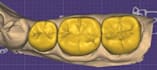 dental cad design service