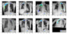develop custom computer vision and deep learning solutions