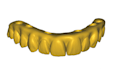 do professional all on x and full arch dental cases on exocad