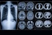 write medical and imaging articles and blog posts