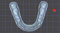 design custom cad night guards and occlusal splints