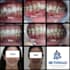 professional clear aligner treatment planning