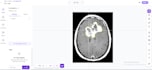 annotate medical images with precise masks, polygons and bounding boxes