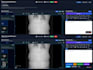 troubleshoot pacs ris dicom dcm4chee and healthcare IT systems