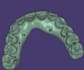 teach you how to design by exocad