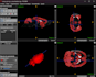 segment and analyze ct and mri medical images in imagej