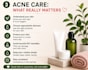 create a personalized acne skin care routine
