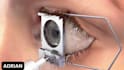 create realistic 3d anatomical medical visualization video, 3d medical animation