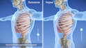 create 3d patient education and surgical procedure animations
