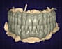 create professional 3d dental cad designs using exocad